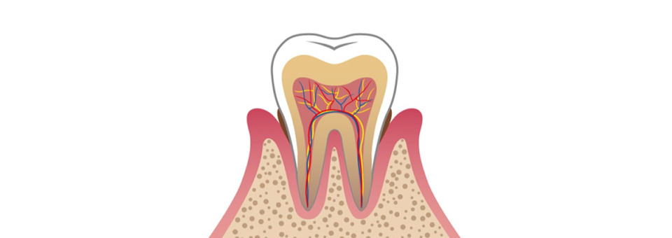 歯周病治療